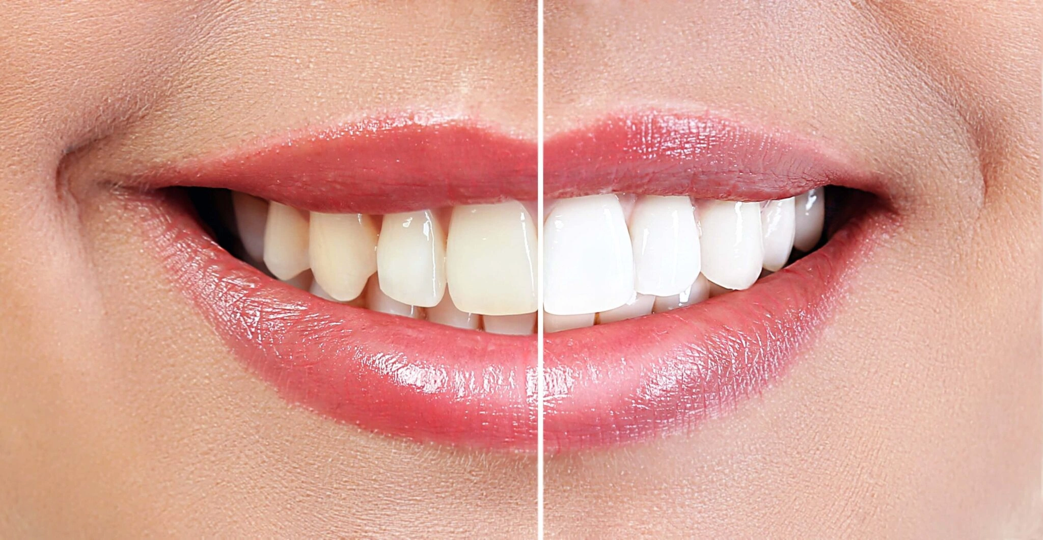 health-and-wellness-cosmetic-dentistry-img-2048x1060